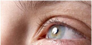 Treat your Watery Eyes