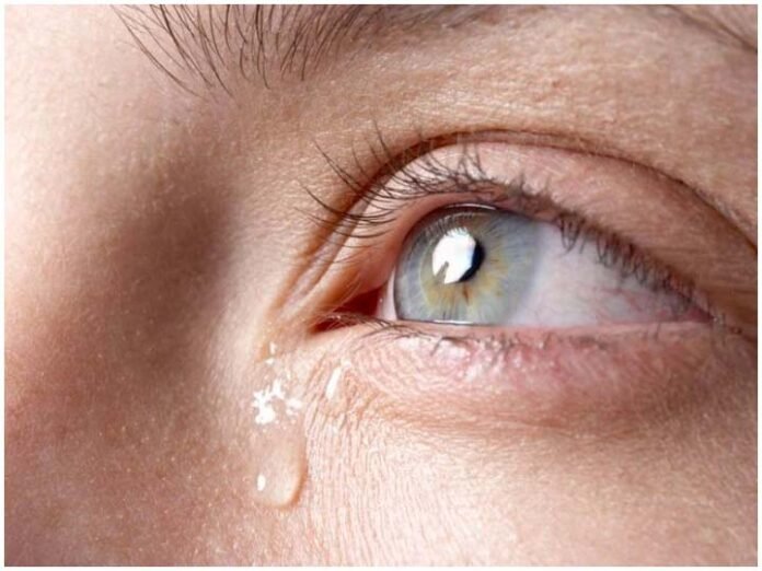 Treat your Watery Eyes